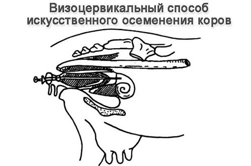 Визоцервикальный способ